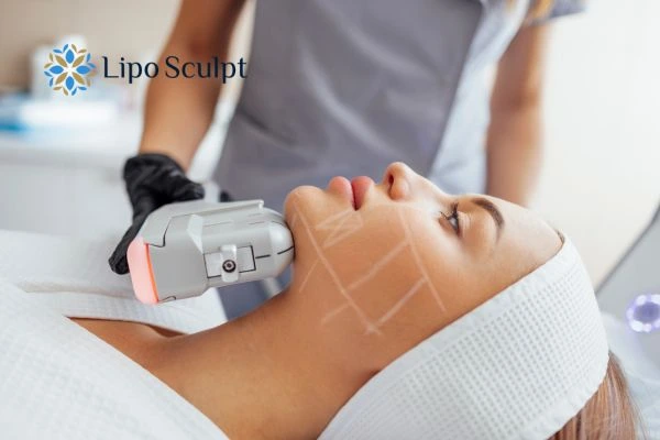 HIFU vs Botulinum Toxin: Understanding the Differences 1 HIFU vs Botox Nuneaton What is the best option for you?