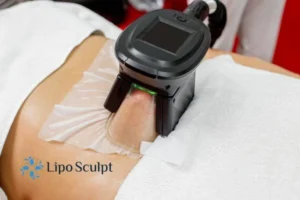 Are The Results From Aqualyx Permanent? 4 Compare Aqualyx Nuneaton to other fat reduction treatments.