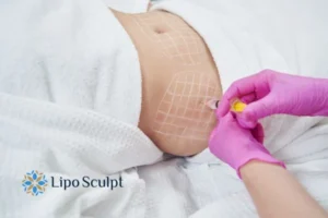 Are The Results From Aqualyx Permanent? 1 Do you want to know how long Aqualyx Nuneaton results last?