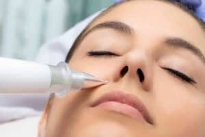 Best Actinic Keratoses Removal 3 Actinic keratoses Nuneaton solutions - book in today!